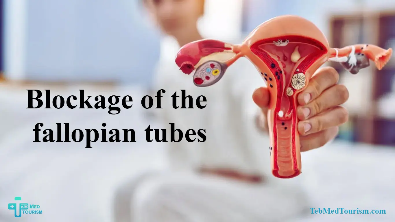 What are the complications of blocked fallopian tubes?