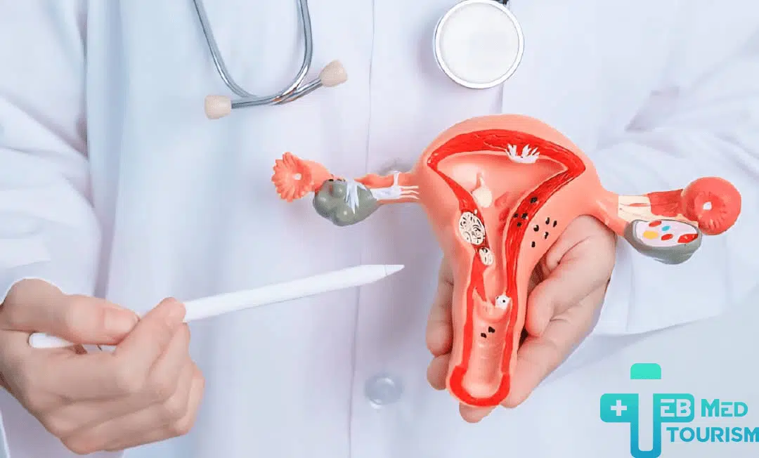 کیفیة تشخيص مرض بطانة الرحم؟