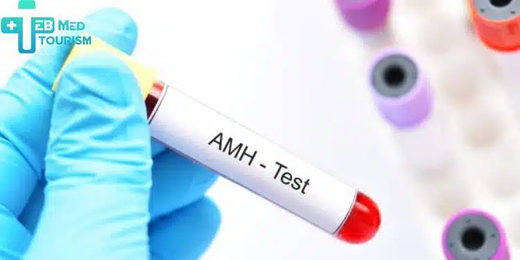 لابد من إجراء تحليل مخزون المبيض لتقييم الصحة الجنسية للزوجة ومعرفة نسبة هرمون ال(AMH).