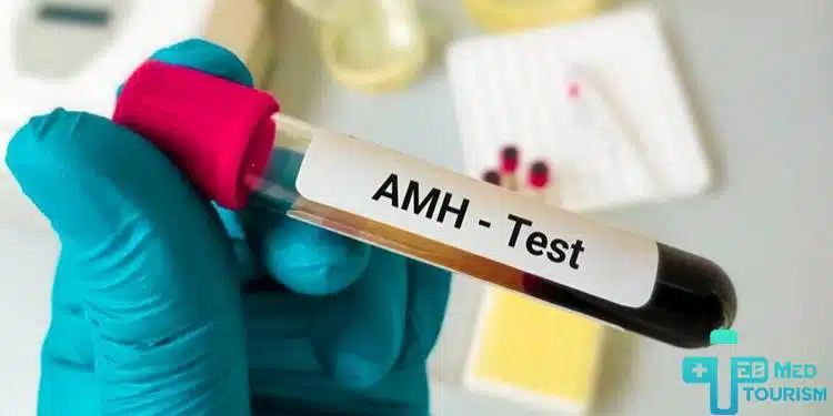 ماهي النسبة الطبيعية لتحلي AMH؟