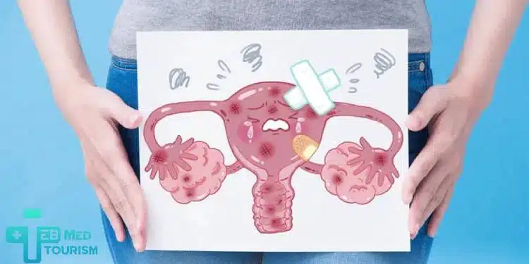 ওভারিয়ান রিজার্ভ