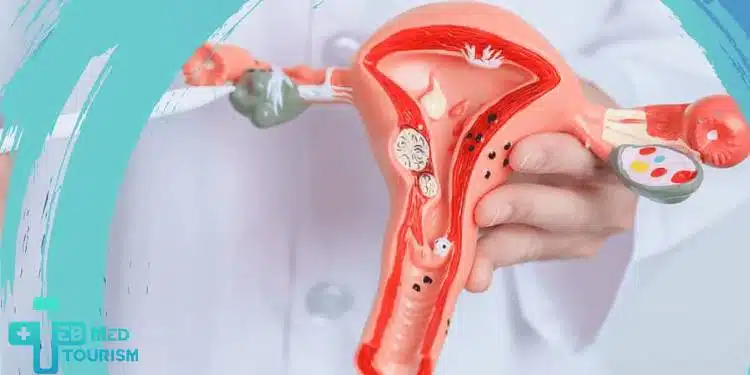 যখন বয়স অনুযায়ী ওভারিয়ান রিজার্ভ কমে যায় এবং IVF বা গর্ভধারণ-এ সমস্যা হয়। এই পর্যায়ে ডিম্বাণু দাতার বয়স IVF-এর সাফল্যের জন্য গুরুত্বপূর্ণ।