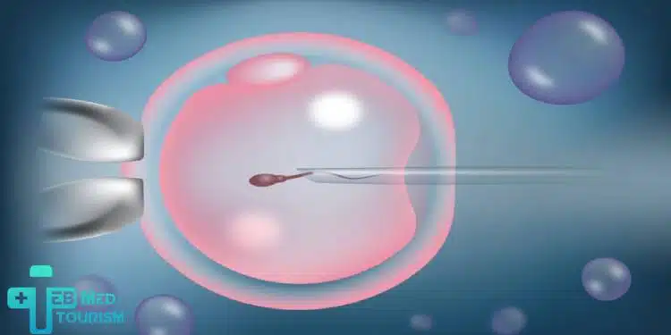 الآثار الجانبية للحقن المجهري في إيران