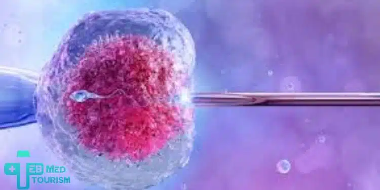 كم يستغرق مدة عملية الحقن المجهري في إيران؟