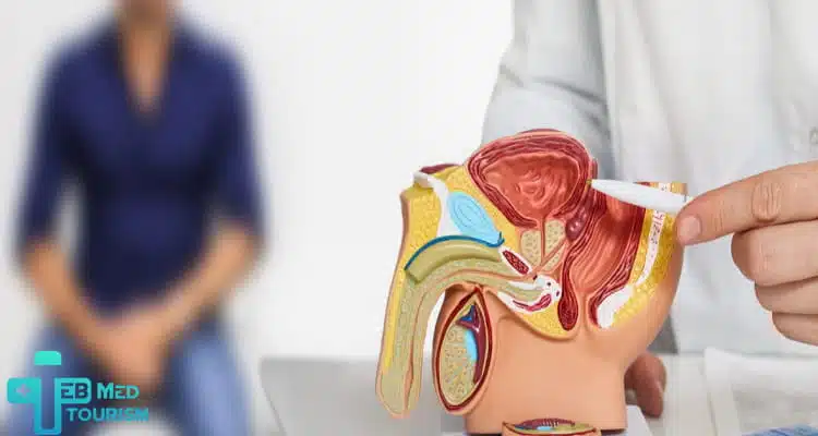 تؤثر العمليات الجراحية السابقة على العقم عند الرجال.