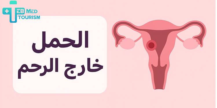 ما هو الحمل خارج الرحم؟
