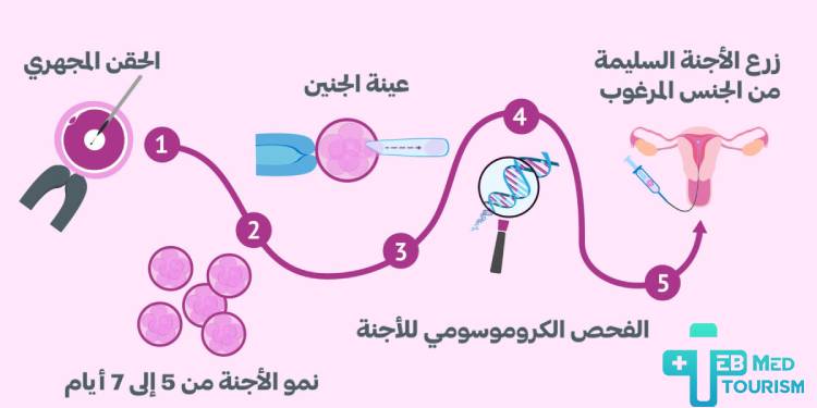تحديد جنس الجنين بالحقن المجهري؛ هل هذا ممكن؟