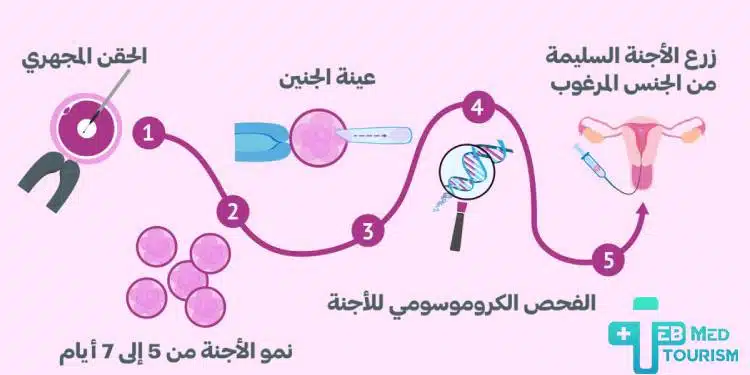 تحديد جنس الجنين بالحقن المجهري؛ هل هذا ممكن؟