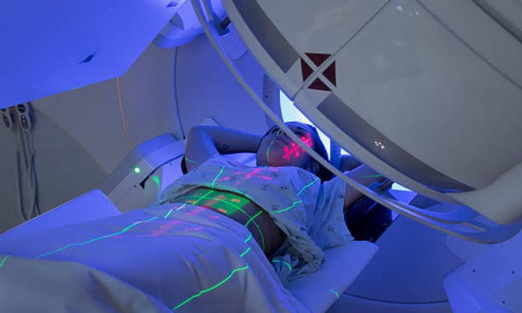 Radiotherapy