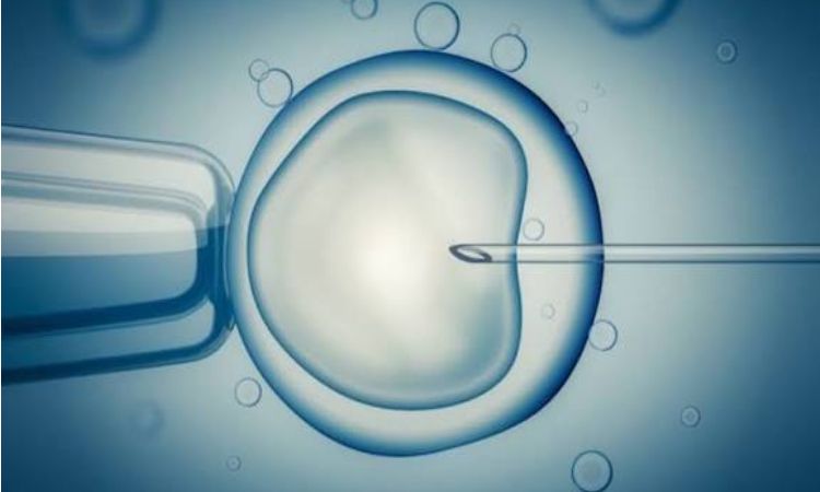 IVF 