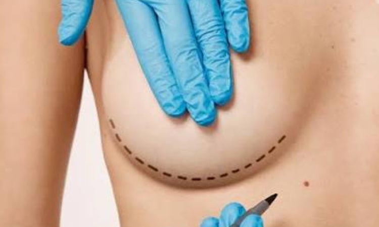 Breast Implant Surgery