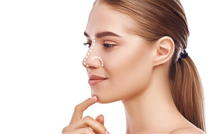 Rhinoplasty (Nose Surgery)