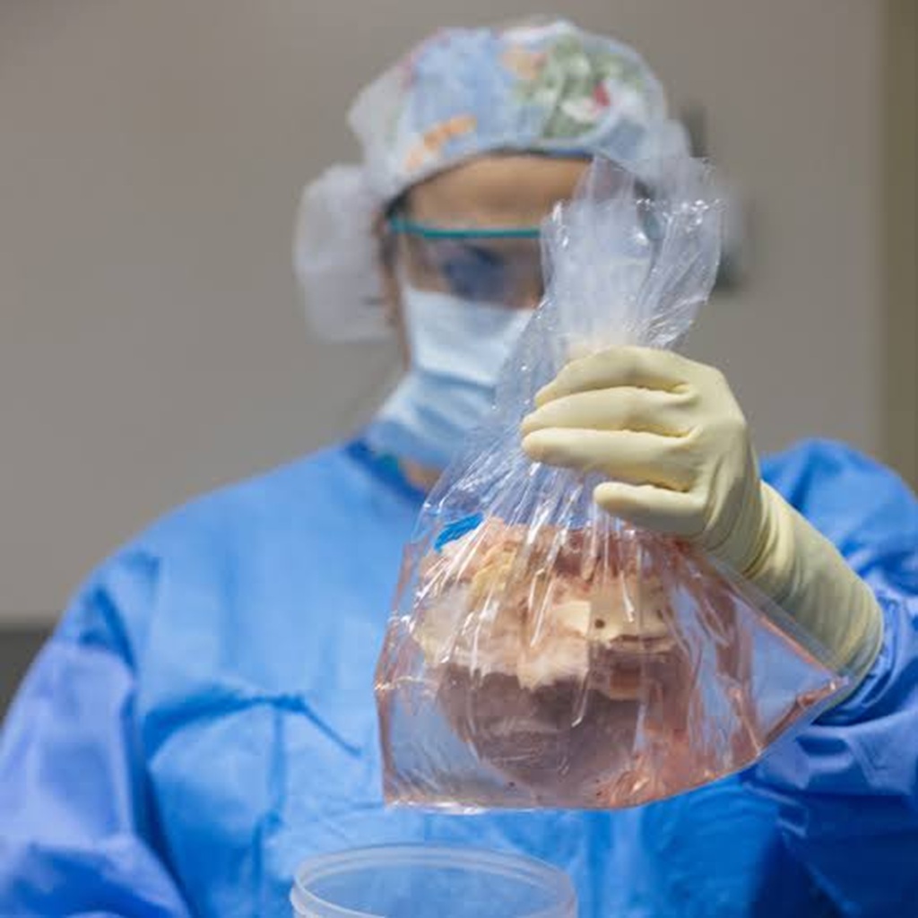 Organ Transplant