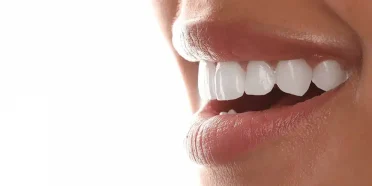 14001001-hollywood-smile-banner