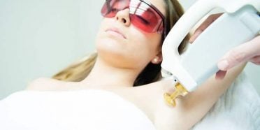 إزالة الشعر بالليزر في إيران