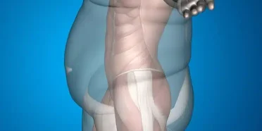 What is the best for weight loss?