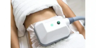 Cryolipolysis-2
