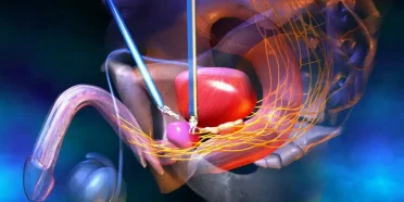 DaVinci-surgery9484894