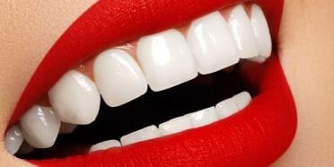 ابتسامة هوليود في إيران