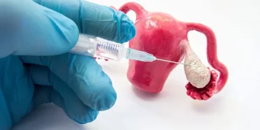 إنضاج البويضات في المختبر IVM & نقل الأجنةET في إيران