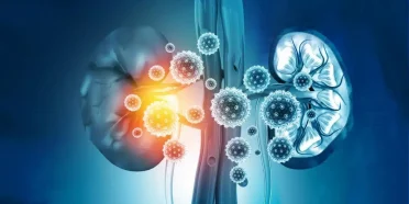 احتمالية الإصابة بالسرطان بعد عملية زراعة الكلية: طرق الوقاية والتشخيص