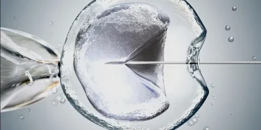 الآثار الجانبية للعلاج بطريقة التقيح الاصطناعي والتقيح داخل الرحم (IUI وIVF)