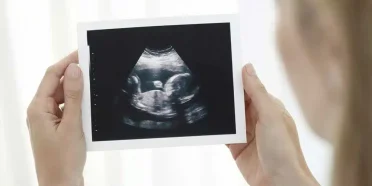 الحمل ما بعد زراعة الكلي