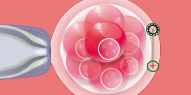 الطرق المساعدة على الإنجاب (الإخصاب)وغرس منطقة الفقس