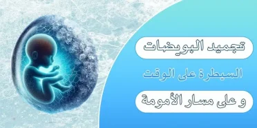 تجمید البویضات