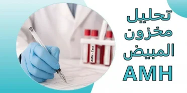 تحليل مخزون المبيض