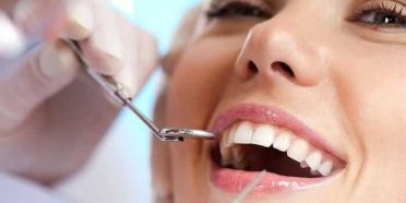 حشوة الأسنان الكومبوزيت أو الحشوة الضوئية