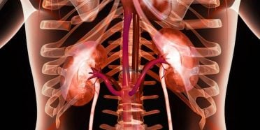 أعراض رفض زراعة الكلية