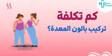 كم تكلفة تركيب بالون المعدة؟