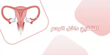 ما هو التلقيح داخل الرحم وهل هي خطيرة ؟