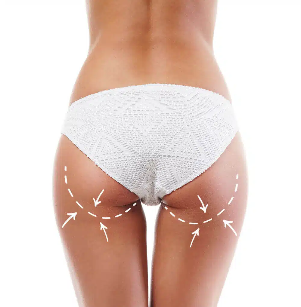 رفع الأرداف