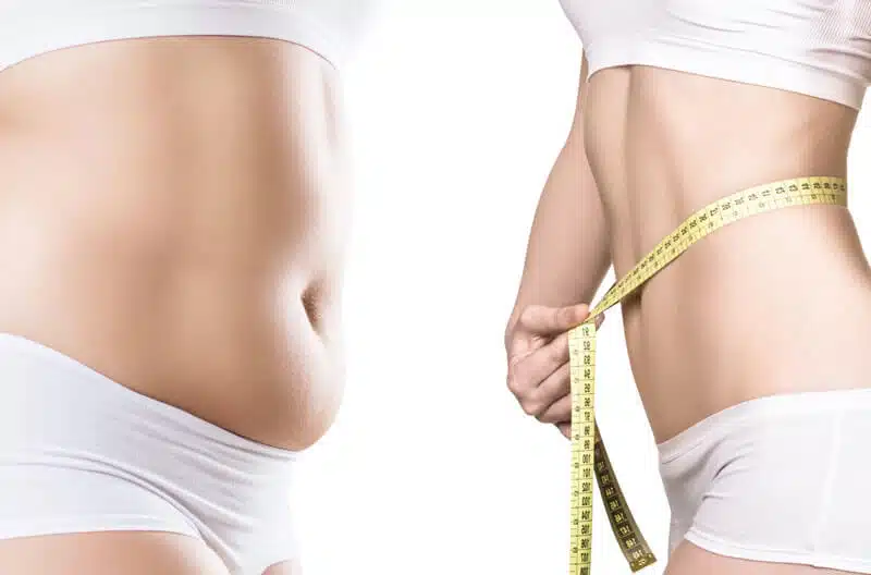 dr-kattashweight-gain-after-tummy-liposuction-1