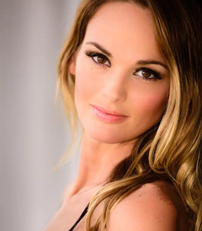 facelift-with-fat-injection