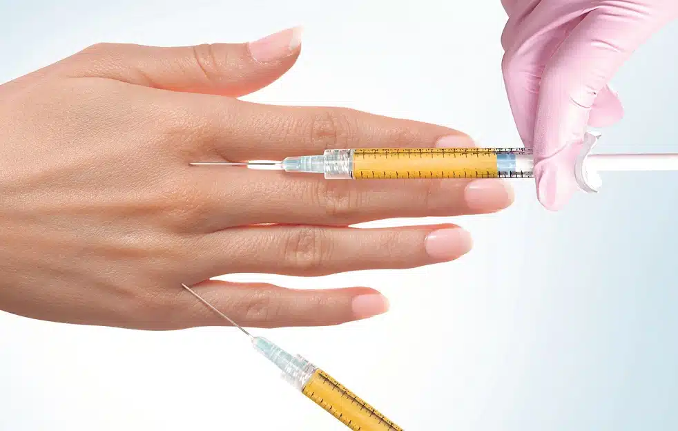 hand-rejuvenation-with-fat-grafting