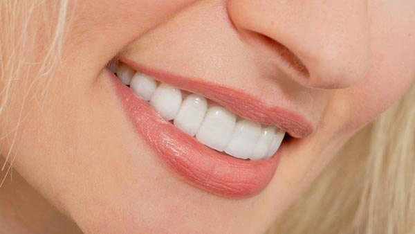 hollywood-smile