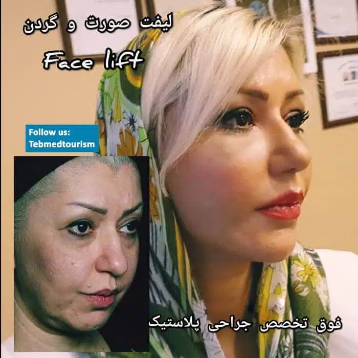 %d8%b4%d8%af-%d8%a7%d9%84%d9%88%d8%ac%d9%87-442