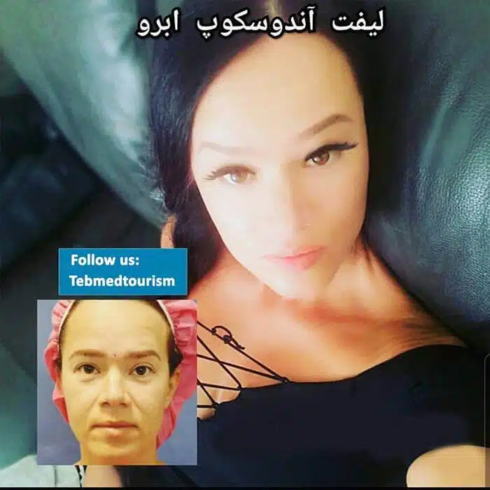 %d8%b4%d8%af-%d8%a7%d9%84%d9%88%d8%ac%d9%8755