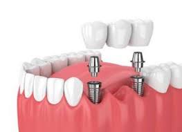 dental5