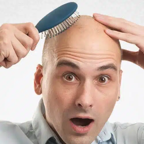 hair-transplant-cost-in-iran-2