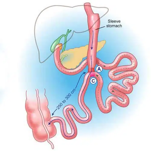 %d8%a8%d8%a7%db%8c-%d9%be%d8%b3-%d8%b1%d9%88%d8%af%d9%87-%d8%a8%d8%b1%d8%a7%db%8c-%da%a9%d8%a7%d9%87%d8%b4-%d9%88%d8%b2%d9%86-500