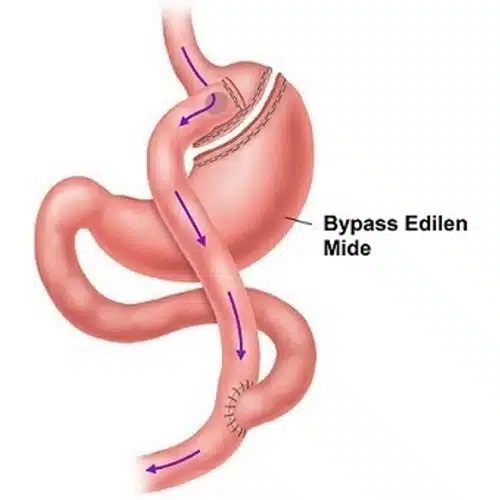 %d8%ac%d8%b1%d8%a7%d8%ad%db%8c-%d8%a8%d8%a7%db%8c-%d9%be%d8%b3-%d9%85%d8%b9%d8%af%d9%87-500x500