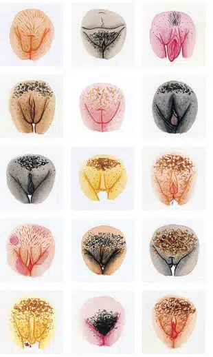 أمور يجب مراعاتها بعد إجراء تجميل الشفرين