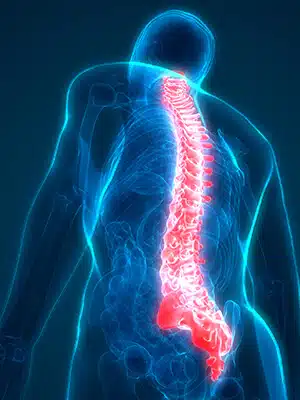 ماذا تتوقع بعد جراحة استئصال القرص