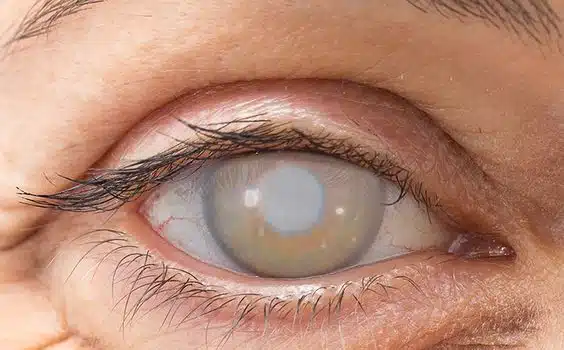 %d8%ac%d8%b1%d8%a7%d8%ad%d8%a9-%d8%a7%d9%84%d8%b3%d8%a7%d8%af