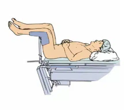 lithotomy_position