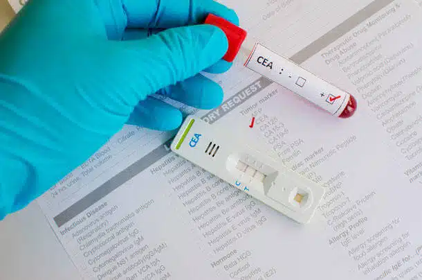 cea-blood-test-tube-article-2